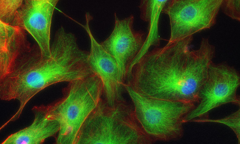 Example of fluorescently stained cell imaging