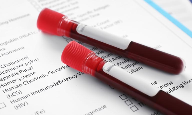 Blood test_biochemical