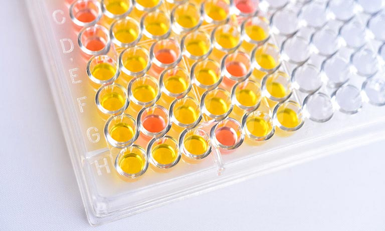 Blood test_biochemical